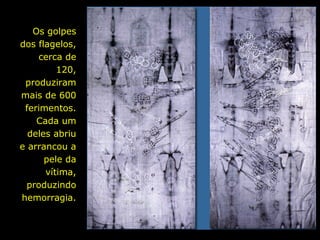 Os golpes
dos flagelos,
cerca de
120,
produziram
mais de 600
ferimentos.
Cada um
deles abriu
e arrancou a
pele da
vítima,
produzindo
hemorragia.

 