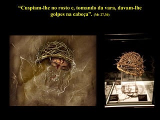 “Cuspiam-lhe no rosto e, tomando da vara, davam-lhe
golpes na cabeça”. (Mt 27,30)

 