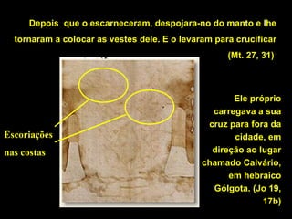 Depois que o escarneceram, despojara-no do manto e lhe
tornaram a colocar as vestes dele. E o levaram para crucificar
(Mt. 27, 31)

Escoriações
nas costas

Ele próprio
carregava a sua
cruz para fora da
cidade, em
direção ao lugar
chamado Calvário,
em hebraico
Gólgota. (Jo 19,
17b)

 