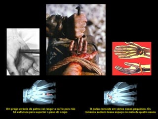 Um prego através da palma vai rasgar a carne pois não
há estrutura para suportar o peso do corpo

O pulso consiste em vários ossos pequenos. Os
romanos sabiam desse espaço no meio de quatro ossos

 