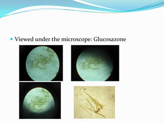 Viewed under the microscope: Glucosazone