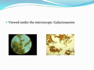 Viewed under the microscope: Galactosazone