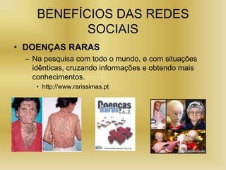 BENEFÍCIOS DAS REDES
           SOCIAIS
• DOENÇAS RARAS
 – Na pesquisa com todo o mundo, e com situações
   idênticas, cruzando informações e obtendo mais
   conhecimentos.
    • http://www.rarissimas.pt
 