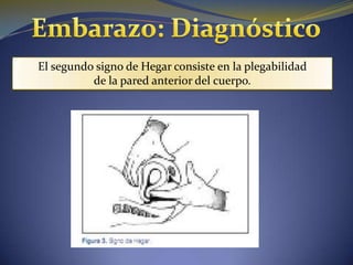 El segundo signo de Hegar consiste en la plegabilidad
          de la pared anterior del cuerpo.
 