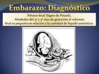 Peloteo fetal (Signo de Pinard).
        Alrededor del 4º y 5º mes de gestación el volumen
fetal es pequeño en relación a la cantidad de líquido amniótico.
 
