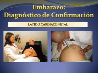 LATIDO CARDIACO FETAL
 