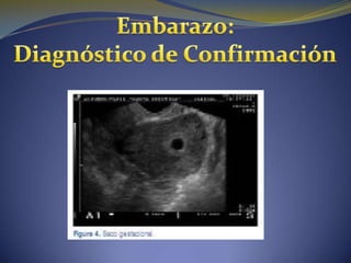 Embarazo normal y diagnostico