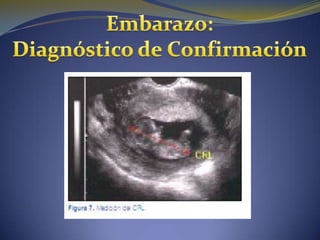Embarazo normal y diagnostico