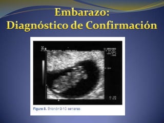 Embarazo normal y diagnostico