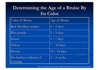 http://www.ncjrs.gov/html/ojjdp/portable_guides/abuse/bruises.html
 