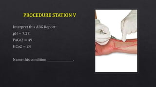 Objective Structured Clinical Examination (OSCE)
