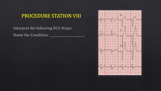 Objective Structured Clinical Examination (OSCE)