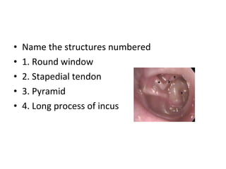 Name the structures numbered 1. Round window 2. Stapedial tendon 3. Pyramid 4. Long process of incus 