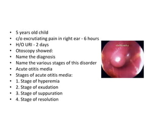5 years old child c/o excrutiating pain in right ear - 6 hours H/O URI - 2 days Otoscopy showed: Name the diagnosis Name the various stages of this disorder Acute otitis media Stages of acute otitis media: 1. Stage of hyperemia 2. Stage of exudation 3. Stage of suppuration 4. Stage of resolution 