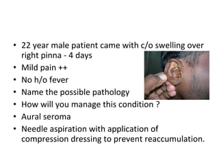 22 year male patient came with c/o swelling over right pinna - 4 days Mild pain ++ No h/o fever Name the possible pathology How will you manage this condition ? Aural seroma Needle aspiration with application of compression dressing to prevent reaccumulation. 