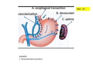 OSCE-Revised PPT for University Exams.pptx