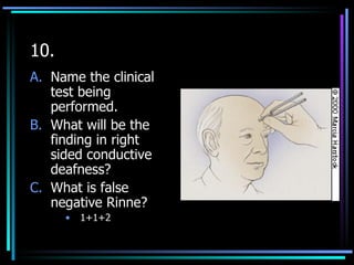Osce 03ans | PPT