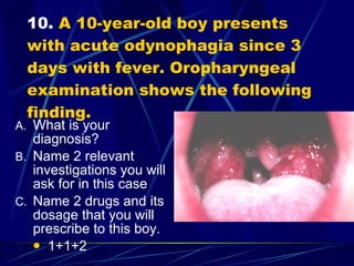 10.  A 10-year-old boy presents with acute odynophagia since 3 days with fever. Oropharyngeal examination shows the following finding. What is your diagnosis? Name 2 relevant investigations you will ask for in this case Name 2 drugs and its dosage that you will prescribe to this boy. 1+1+2 