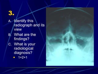 3. Identify this radiograph and its view What are the findings? What is your radiological diagnosis? 1+2+1 