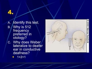 4. Identify this test. Why is 512 frequency preferred in otology? Why does Weber lateralize to deafer ear in conductive deafness? 1+2+1 