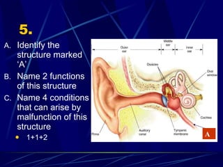 5. Identify the structure marked ‘A’ Name 2 functions of this structure Name 4 conditions that can arise by malfunction of this structure 1+1+2 A 