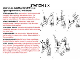 Dangle Method Obstetrics and Gynaecology osce question and answers | PPTX