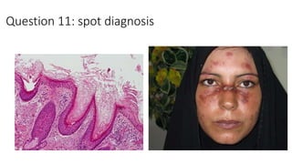 Question 11: spot diagnosis
 