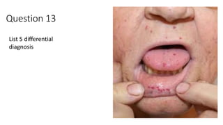 Question 13
List 5 differential
diagnosis
 