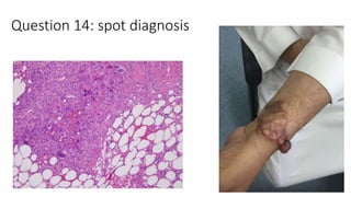 Question 14: spot diagnosis
 