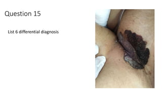 Question 15
List 6 differential diagnosis
 
