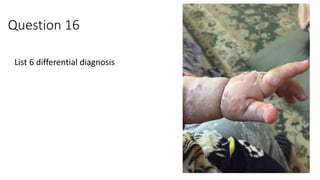 Question 16
List 6 differential diagnosis
 