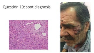 Question 19: spot diagnosis
 