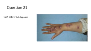 Question 21
List 5 differential diagnosis
 