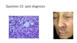 Question 22: spot diagnosis
 