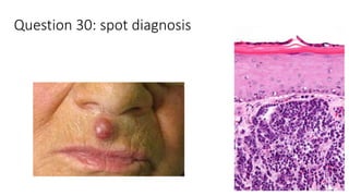 Question 30: spot diagnosis
 