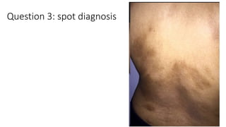 Question 3: spot diagnosis
 