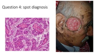 Question 4: spot diagnosis
 