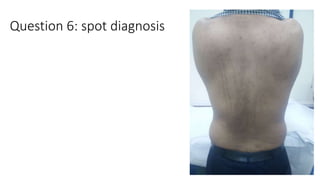 Question 6: spot diagnosis
 