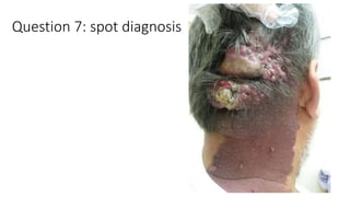 Question 7: spot diagnosis
 