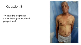 Question 8
- What is the diagnosis?
- What investigations would
you perform?
 