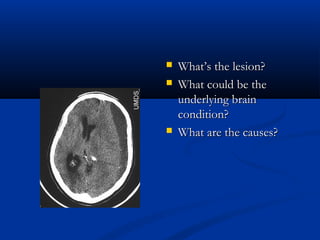    What’s the lesion?
   What could be the
    underlying brain
    condition?
   What are the causes?
 