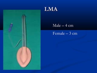 LMA

 Male – 4 cm
 Female – 3 cm
 