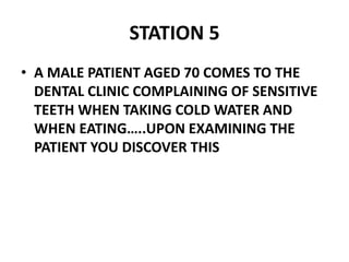 STATION 5
• A MALE PATIENT AGED 70 COMES TO THE
DENTAL CLINIC COMPLAINING OF SENSITIVE
TEETH WHEN TAKING COLD WATER AND
WHEN EATING…..UPON EXAMINING THE
PATIENT YOU DISCOVER THIS
 