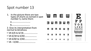 Osce exam for nta level 6 ophthalmology | PPTX