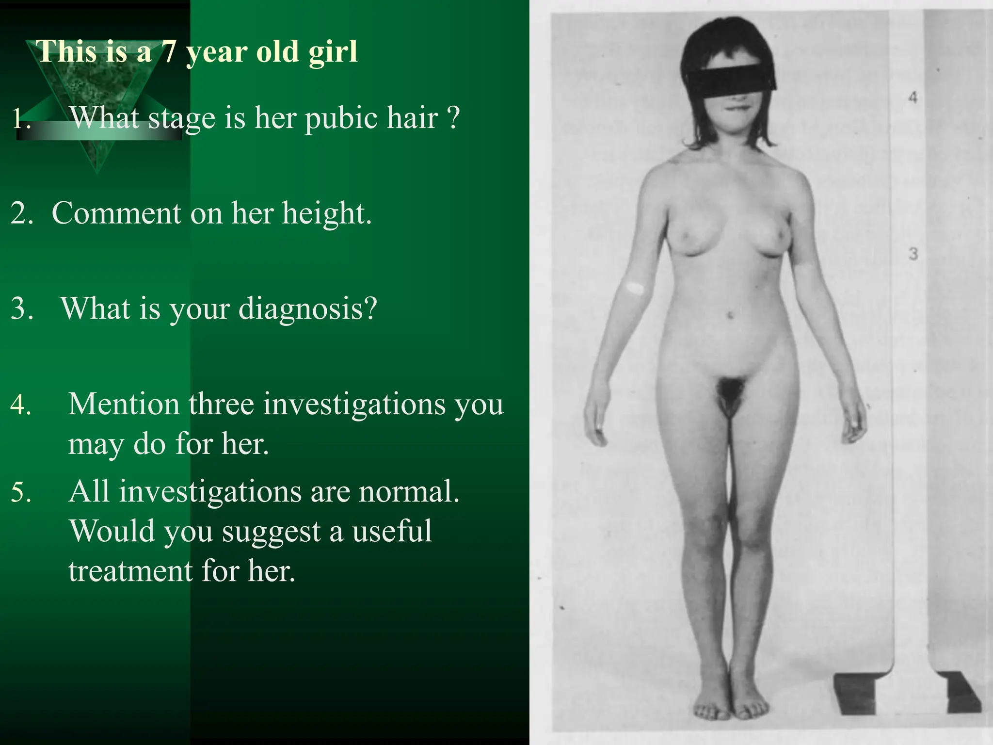 This is a 7 year old girl
1. What stage is her pubic hair ?
2. Comment on her height.
3. What is your diagnosis?
4. Mention three investigations you
may do for her.
5. All investigations are normal.
Would you suggest a useful
treatment for her.
 