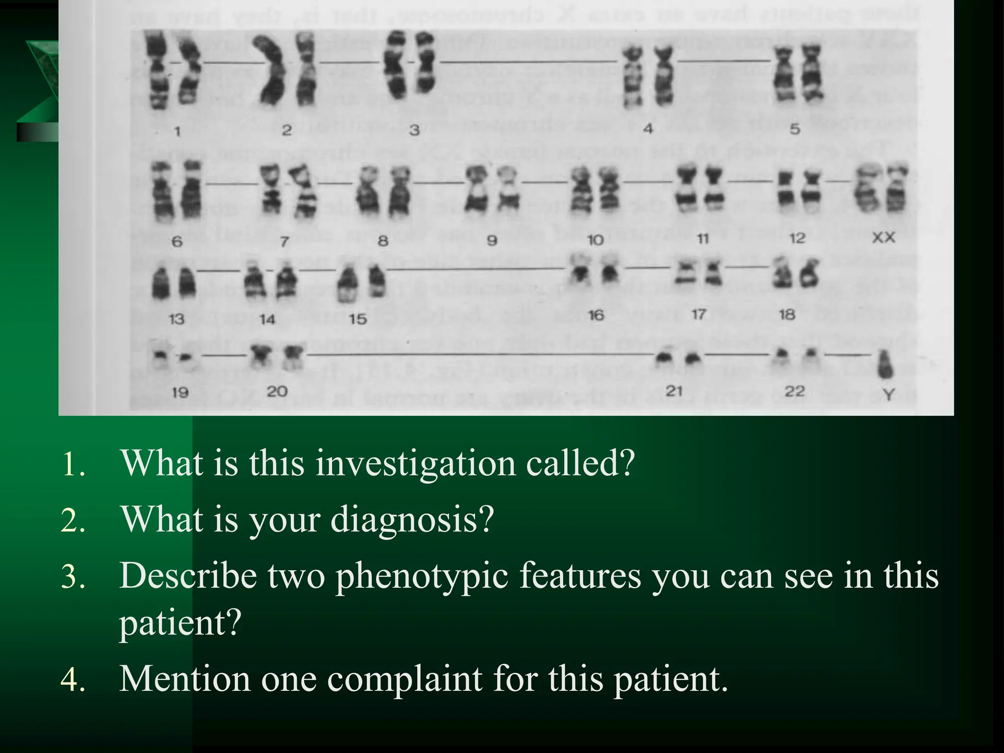 1. What is this investigation called?
2. What is your diagnosis?
3. Describe two phenotypic features you can see in this
patient?
4. Mention one complaint for this patient.
 