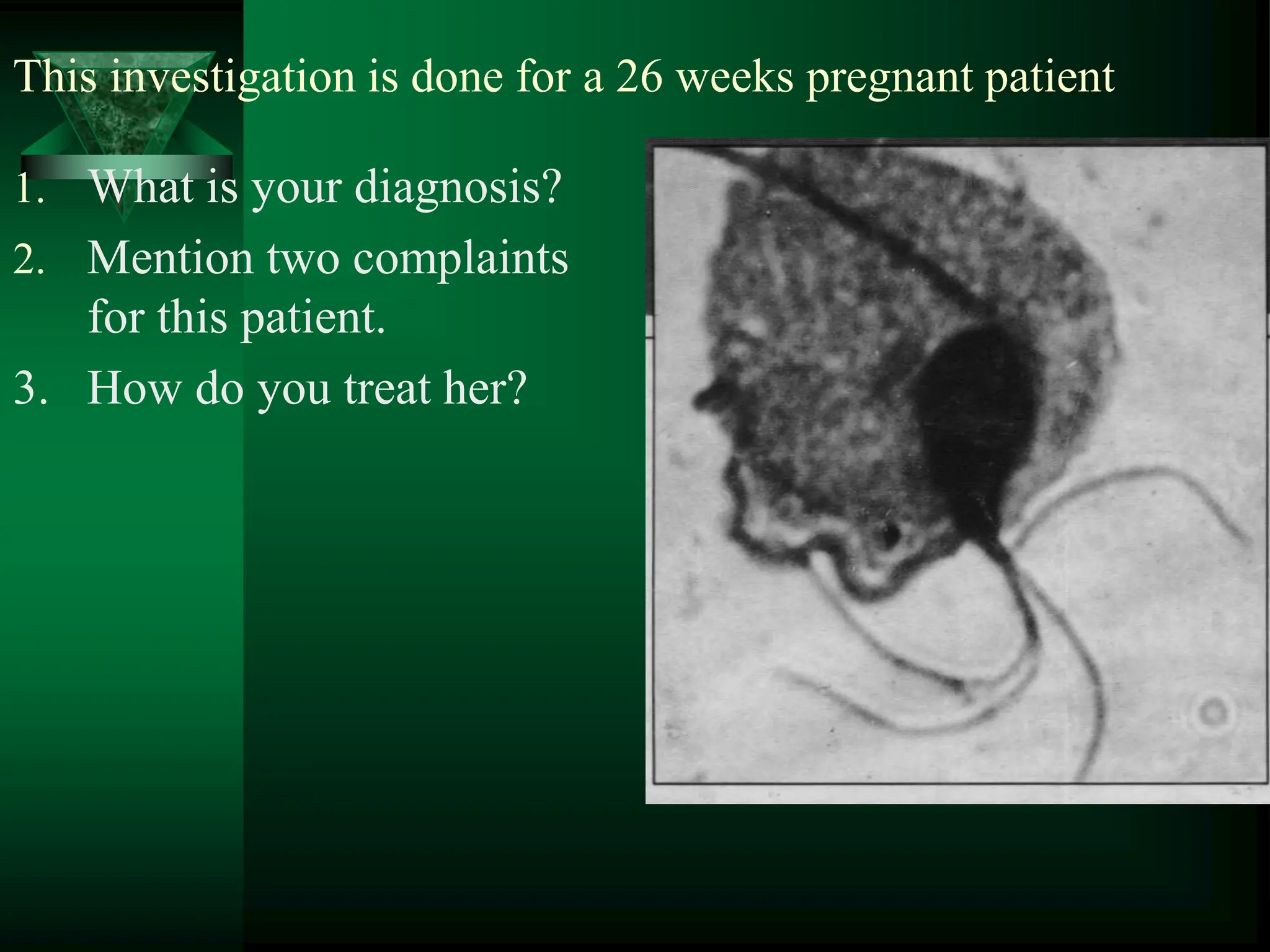 This investigation is done for a 26 weeks pregnant patient
1. What is your diagnosis?
2. Mention two complaints
for this patient.
3. How do you treat her?
 
