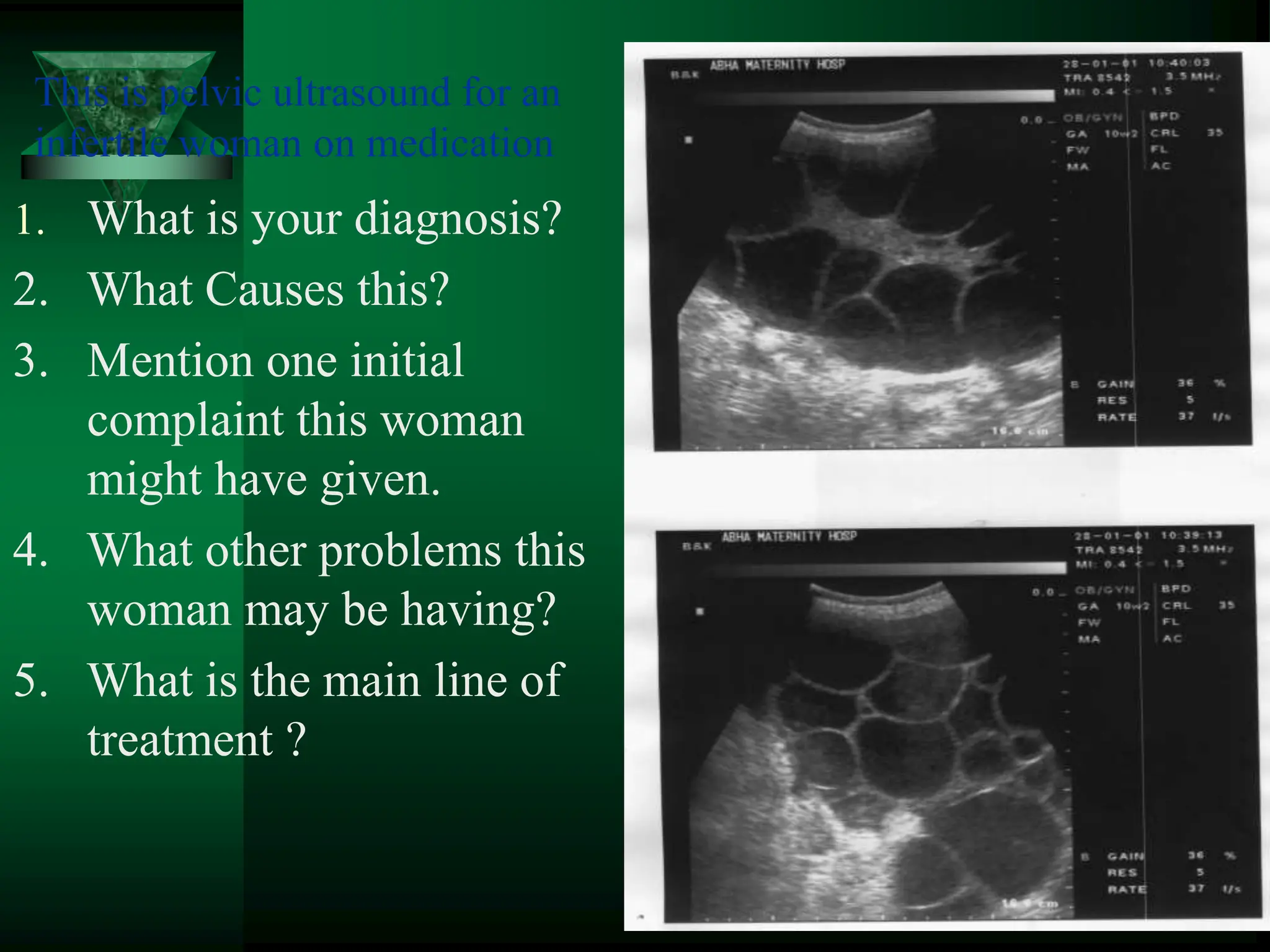 This is pelvic ultrasound for an
infertile woman on medication
1. What is your diagnosis?
2. What Causes this?
3. Mention one initial
complaint this woman
might have given.
4. What other problems this
woman may be having?
5. What is the main line of
treatment ?
 