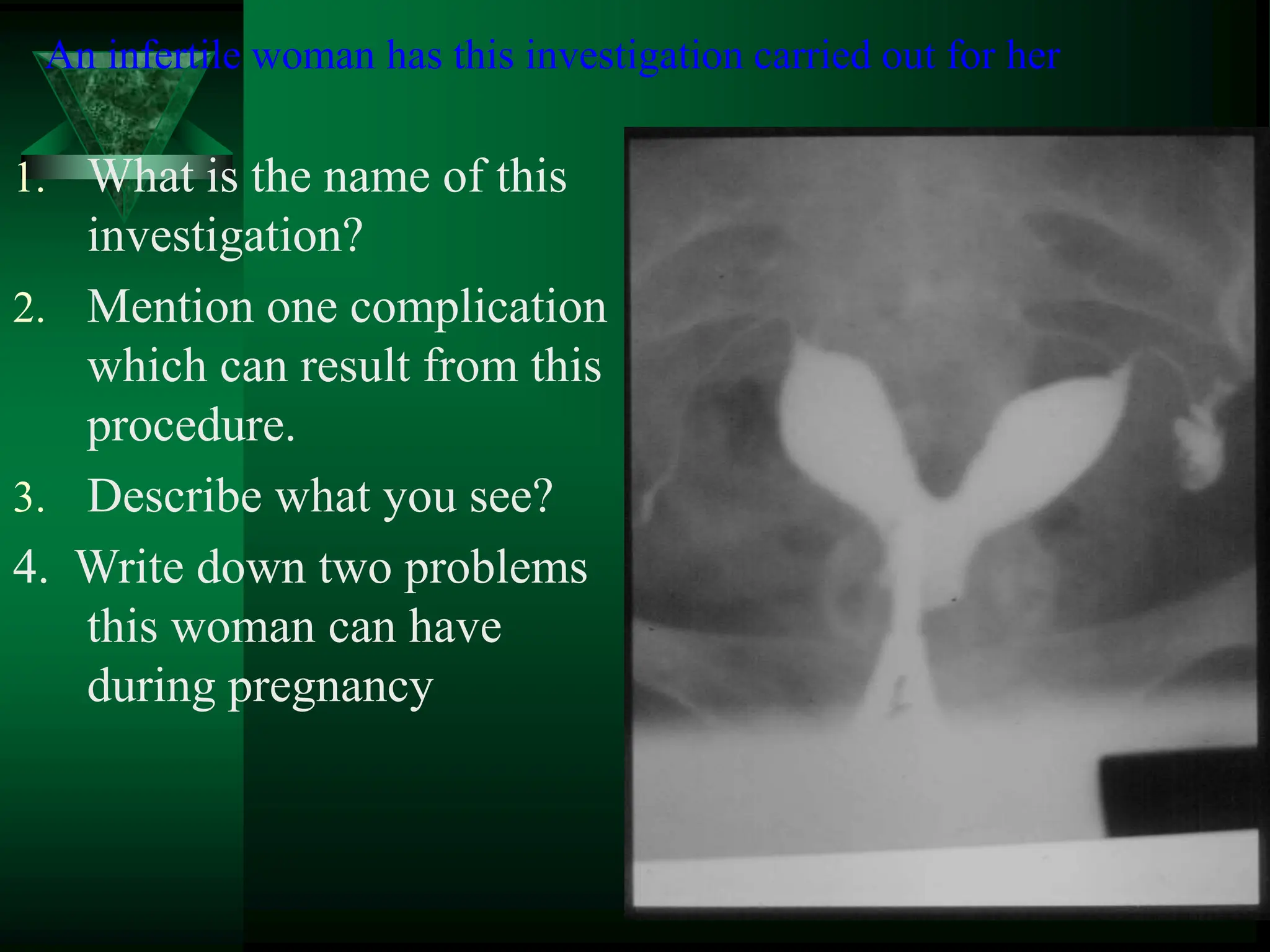 An infertile woman has this investigation carried out for her
1. What is the name of this
investigation?
2. Mention one complication
which can result from this
procedure.
3. Describe what you see?
4. Write down two problems
this woman can have
during pregnancy
 