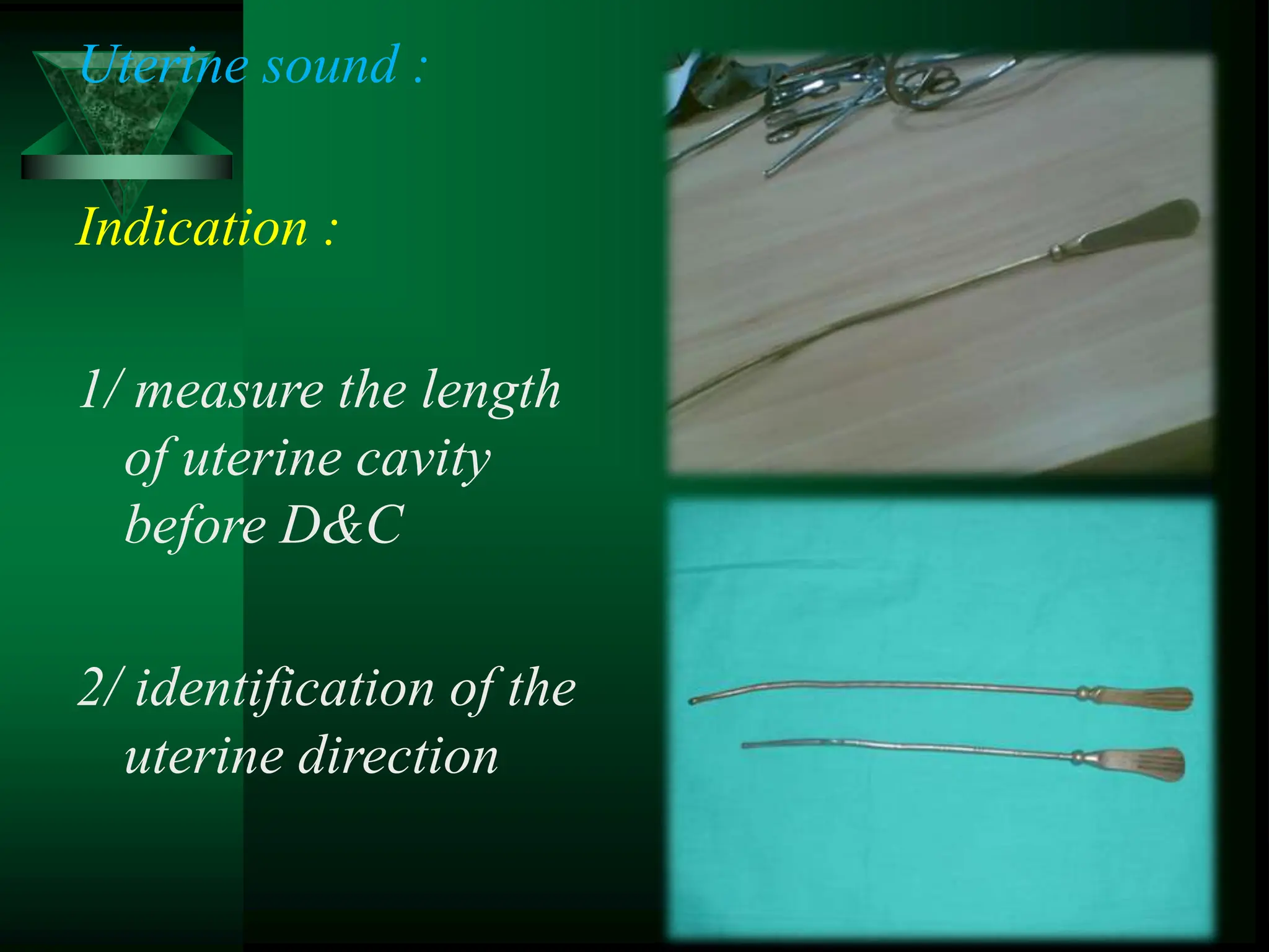 Uterine sound :
Indication :
1/ measure the length
of uterine cavity
before D&C
2/ identification of the
uterine direction
 
